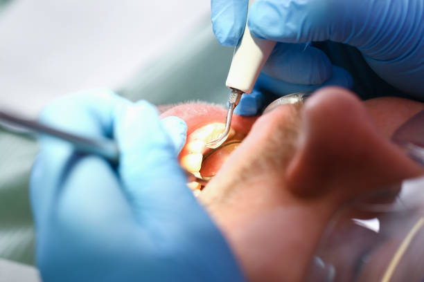 Best Pediatric Emergency Dentist in Shawsville, VA