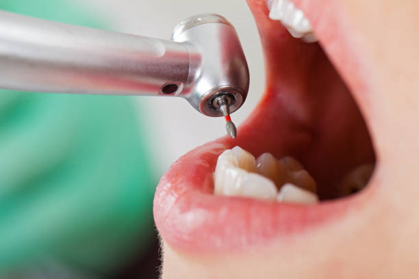 Best Pediatric Emergency Dentist in Shawsville, VA